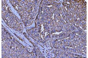 IHC analysis of CD147/Emmprin using anti-CD147/Emmprin antibody (ABIN7599999).