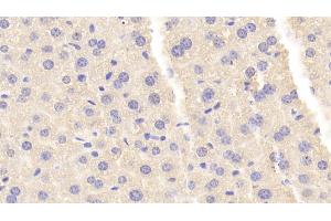 Detection of CARNS1 in Mouse Liver Tissue using Polyclonal Antibody to Carnosine Synthase 1 (CARNS1) (CARNS1 抗体  (AA 623-826))