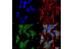 Immunocytochemistry/Immunofluorescence analysis using Rabbit Anti-UVRAG Polyclonal Antibody . (UVRAG 抗体  (C-Term) (FITC))