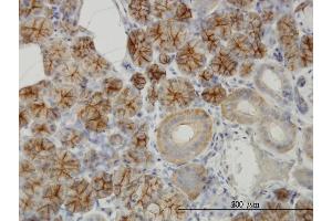 Immunoperoxidase of monoclonal antibody to RHCG on formalin-fixed paraffin-embedded human salivary gland. (RHCG 抗体  (AA 418-479))