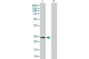 Western Blot analysis of SPA17 expression in transfected 293T cell line by SPA17 MaxPab polyclonal antibody. (SPA17 抗体  (AA 1-151))