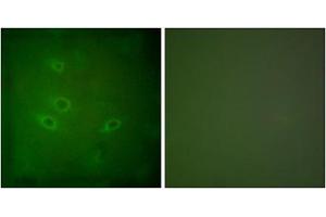 Immunofluorescence analysis of HeLa cells, using CARD6 antibody. (CARD6 抗体  (N-Term))