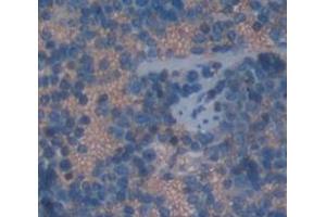 Immunohistochemistry (IHC) image for anti-Nitric Oxide Synthase 2, Inducible (NOS2) (AA 868-909) antibody (ABIN1860032)