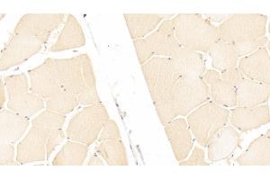 Detection of ITIH3 in Human Skeletal muscle Tissue using Polyclonal Antibody to Inter Alpha-Globulin Inhibitor H3 (ITIH3) (ITIH3 抗体  (AA 279-467))