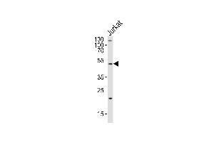 Western blot analysis of lysate from Jurkat cell line, using GAA Antibody at 1:2000. (GAA 抗体  (N-Term))