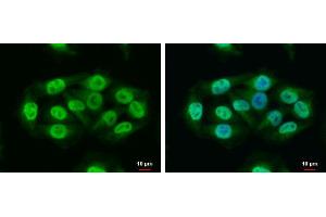 ICC/IF Image RAP1 antibody [N2C3] detects RAP1 protein at nucleus and cytoplasm by immunofluorescent analysis. (RAP1 抗体  (Center))