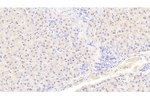 Immunohistochemistry (IHC) image for anti-Cystatin E/M (CST6) (AA 29-149) antibody (ABIN7436651)