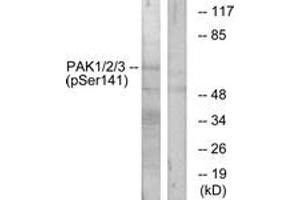 Western blot analysis of extracts from mouse brain, using PAK1/2/3 (Phospho-Ser144/141/139) Antibody. (PAK1/2/3 抗体  (pSer144))