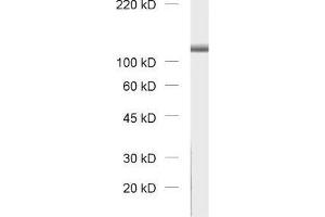 dilution: 1 : 1000, sample: rat brain homogenate (VPS18 抗体)