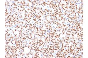 Immunohistochemistry (IHC) image for anti-Paired Box 8 (PAX8) (AA 60-261) antibody (ABIN6940924)