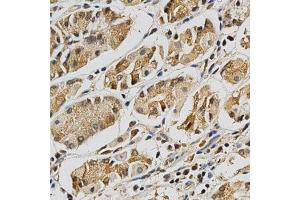 Immunohistochemistry of paraffin-embedded human stomach using LGALS3 antibody at dilution of 1:200 (x400 lens) (Galectin 3 抗体  (AA 1-250))