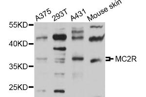 Western blot analysis of extracts of various cell lines, using MC2R antibody (ABIN5971545) at 1/1000 dilution. (MC2R 抗体)