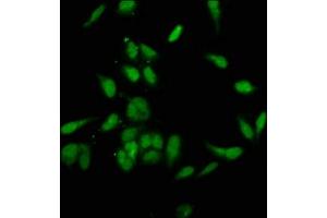 Immunofluorescence staining of Hela cells with ABIN7145812 at 1:200, counter-stained with DAPI. (BRD4 抗体  (AA 150-200))