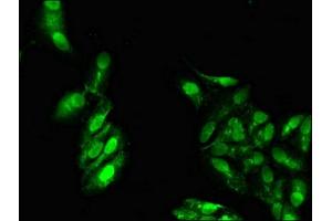 Immunofluorescent analysis of Hela cells using ABIN7164586 at dilution of 1:100 and Alexa Fluor 488-congugated AffiniPure Goat Anti-Rabbit IgG(H+L)
