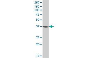 AKR1C1 MaxPab polyclonal antibody. (AKR1C1 抗体  (AA 1-323))