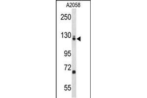 Western blot analysis of EFTUD2 Antibody (Center) (ABIN653236 and ABIN2842767) in  cell line lysates (35 μg/lane). (EFTUD2 抗体  (AA 257-284))