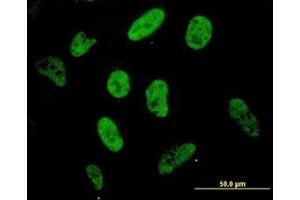 Image no. 4 for anti-Sp1 Transcription Factor (SP1) (AA 89-199) antibody (ABIN598936)