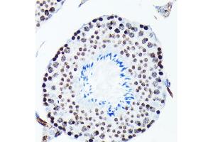 Immunohistochemistry of paraffin-embedded mouse testis using Phospho-Histone H2AX-S139 antibody (ABIN6135258, ABIN6136140, ABIN6136141 and ABIN7101881) at dilution of 1:100 (40x lens). (Histone H2A 抗体  (pSer139))