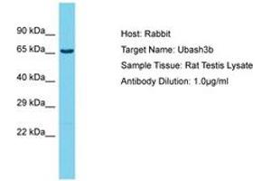 Image no. 1 for anti-Cbl-Interacting Protein Sts-1 (STS1) (AA 564-613) antibody (ABIN6750419) (UBASH3B 抗体  (AA 564-613))