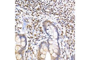 Immunohistochemistry of paraffin-embedded human small intestine using TR Rabbit mAb (ABIN7270870) at dilution of 1:200 (40x lens). (TRAPPC2 抗体)