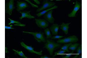 Immunofluorescence of monoclonal antibody to PAFAH1B1 on HeLa cell. (PAFAH1B1 抗体  (AA 1-110))