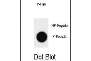 Dot Blot (DB) image for anti-C-Abl Oncogene 1, Non-Receptor tyrosine Kinase (ABL1) (pTyr412) antibody (ABIN3001744) (ABL1 抗体  (pTyr412))