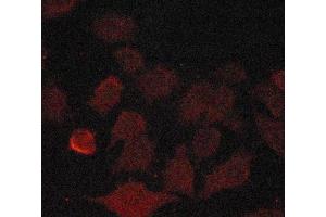 ABIN6269146 staining A549 cells by ICC/IF. (Cyclin B1 抗体  (Internal Region))