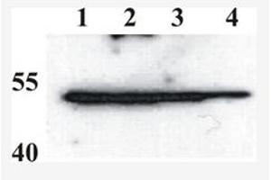 Western Blotting (WB) image for anti-BPV-1 (AA 208-218) antibody (ABIN781764) (BPV-1 (AA 208-218) 抗体)