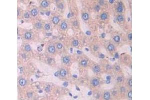 IHC-P analysis of Kidney tissue, with DAB staining. (Surfactant Protein C 抗体  (AA 1-194))