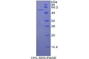 SDS-PAGE (SDS) image for Beta-secretase 1 (BACE1) (AA 190-430) protein (His tag,GST tag) (ABIN1879502) (BACE1 Protein (AA 190-430) (His tag,GST tag))