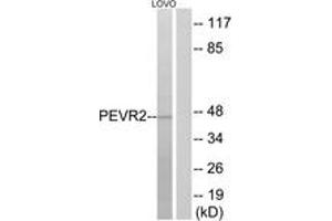Western blot analysis of extracts from LOVO cells, using PEVR2 Antibody. (PEVR2 (AA 235-284) 抗体)