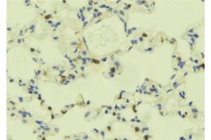 ABIN6273695 at 1/100 staining Mouse lung tissue by IHC-P. (PLCE1 抗体)