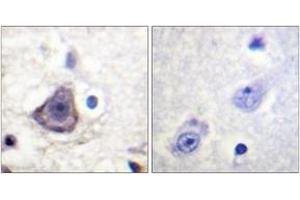 Immunohistochemistry analysis of paraffin-embedded human brain, using HER3 (Phospho-Tyr1222) Antibody. (ERBB3 抗体  (pTyr1222))