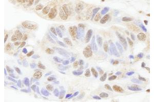 Immunohistochemistry (IHC) image for anti-Poly (ADP-Ribose) Polymerase 1 (PARP1) (AA 50-100) antibody (ABIN7448996)