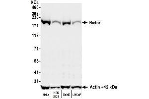anti-RPTOR Independent Companion of mTOR, Complex 2 (RICTOR) (C-Term) antibody