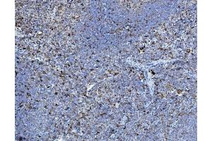 IHC analysis of P4HB using anti-P4HB antibody (ABIN7600075). (P4HB 抗体  (AA 146-363))