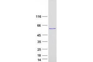 Western Blotting (WB) image for RAP1, GTP-GDP Dissociation Stimulator 1 (RAP1GDS1) (Transcript Variant 3) protein (Myc-DYKDDDDK Tag) (ABIN2730477)
