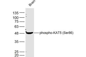 Mouse brain lysates probed with KAT5 (Ser86) Polyclonal Antibody, Unconjugated  at 1:300 dilution and 4˚C overnight incubation. (KAT5 抗体  (pSer86))