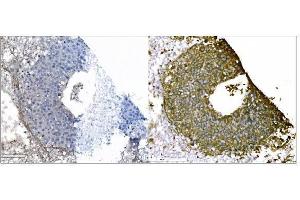 IHC analysis of IGF2R using anti-IGF2R antibody (ABIN7601706).