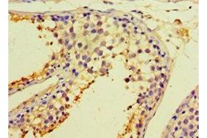 Immunohistochemistry of paraffin-embedded human testis tissue using ABIN7146575 at dilution of 1:100 (Calreticulin 3 抗体  (AA 135-384))