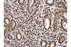 Immunohistochemistry (IHC) image for anti-PSME3 (PSME3) antibody (ABIN2856424)