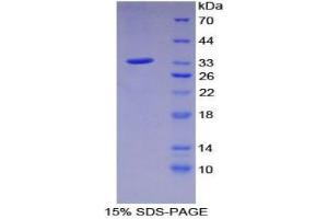 SDS-PAGE analysis of Mouse C2CD3 Protein. (C2CD3 蛋白)