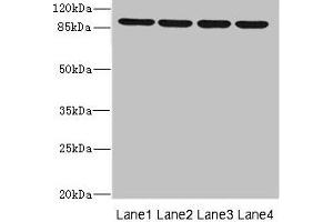 Western blot All lanes: ITGB8 antibody at 1. (ITGB8 抗体  (AA 43-320))