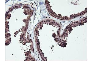 Immunohistochemical staining of paraffin-embedded Human breast tissue using anti-NHEJ1 mouse monoclonal antibody. (NHEJ1 抗体)
