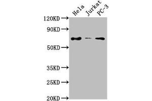 Western Blot Positive WB detected in: Hela whole cell lysate, Jurkat whole cell lysate, PC-3 whole cell lysate All lanes: PRICKLE3 antibody at 1:2000 Secondary Goat polyclonal to rabbit IgG at 1/50000 dilution Predicted band size: 69, 60 kDa Observed band size: 69 kDa (PRICKLE3 抗体  (AA 9-24))