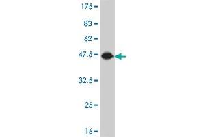 Western Blot detection against Immunogen (45. (NAT5 抗体  (AA 1-178))