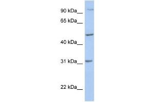 PPM1J antibody used at 1 ug/ml to detect target protein. (PPM1J 抗体)