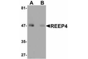 Image no. 1 for anti-Receptor Accessory Protein 4 (REEP4) (Internal Region) antibody (ABIN478105) (Receptor Accessory Protein 4 抗体  (Internal Region))
