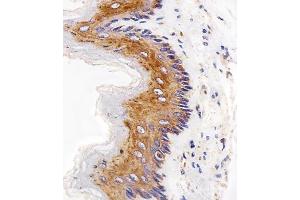 Immunohistochemical analysis of paraffin-embedded R. (EGFR 抗体  (C-Term))