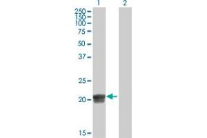Western Blot analysis of RGS5 expression in transfected 293T cell line by RGS5 MaxPab polyclonal antibody. (RGS5 抗体  (AA 1-181))